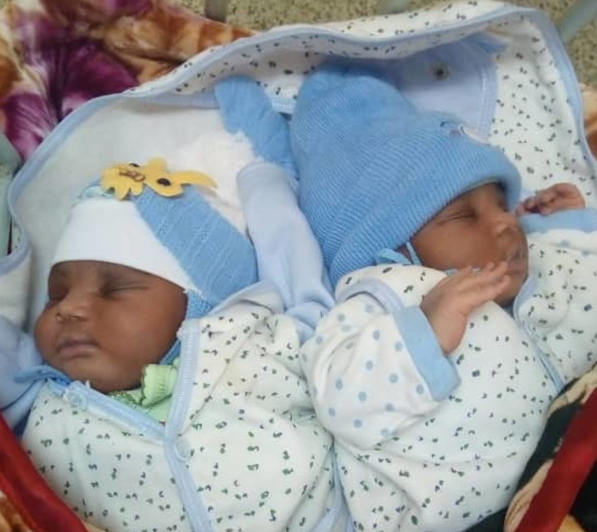 Cameroon Couple Cries for Help for Conjoined Twins - CameroonOnline.org